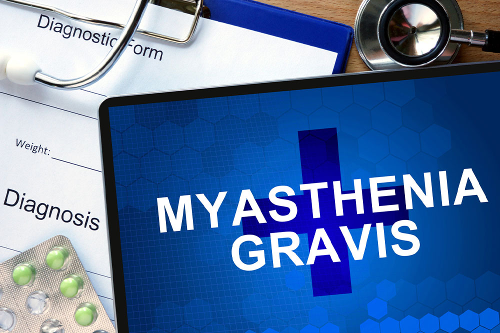 Top Therapies for Those With Myasthenia Gravis