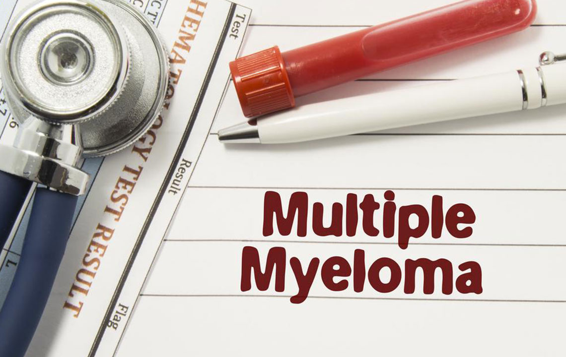 Common types of multiple myeloma and their treatments