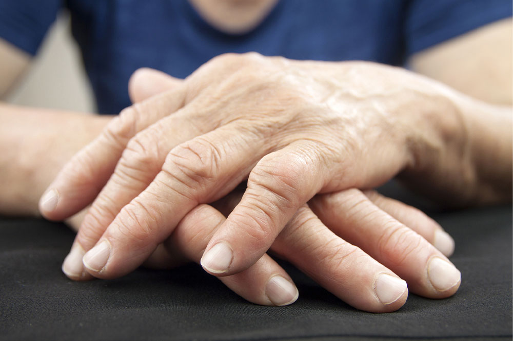 7 tips for living better with rheumatoid arthritis