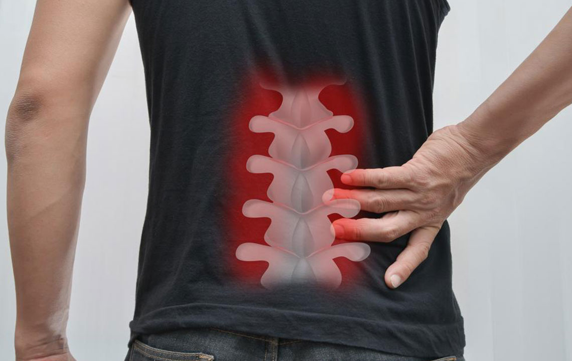 A brief overview of spinal fusion surgery