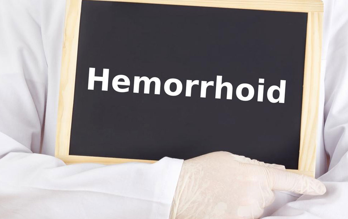 Get Relief with These Effective Hemorrhoids Treatment Options