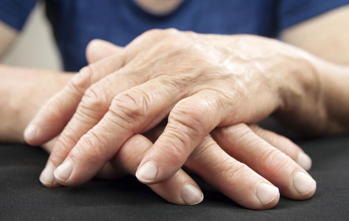 Easy Ways to Manage Psoriatic Arthritis